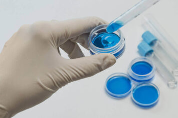 Natural remedies for quick bruising